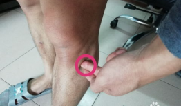 怎样艾灸足三里视频,视频教程助您养生保健